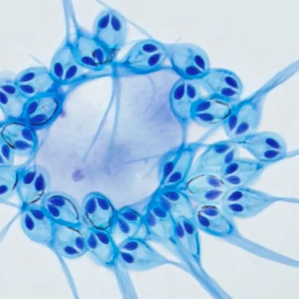 Henneguya salminicola Animais - Henneguya salminicola