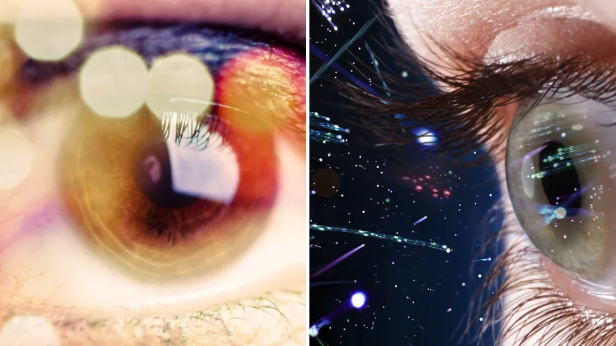 Por que vemos faíscas ao fechar os olhos?